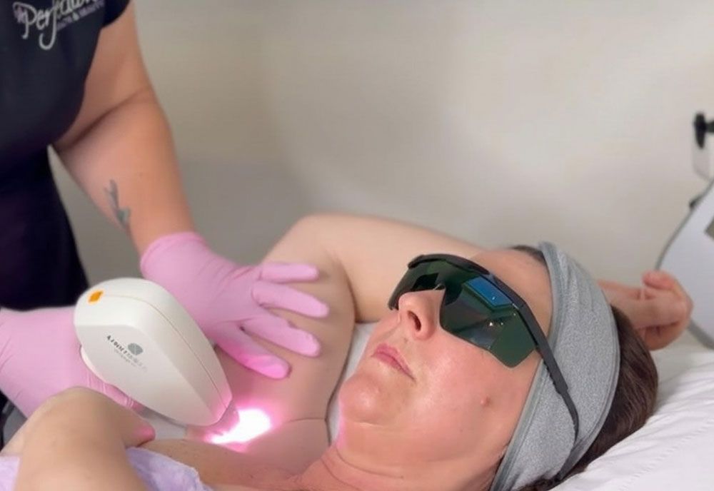 laser hair removal in progress