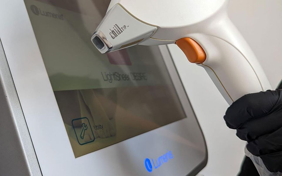 laser hair removal treatment
