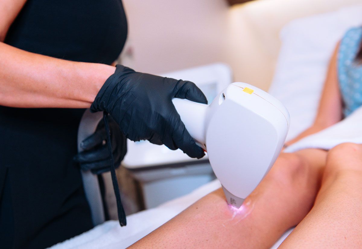 laser hair removal in progress