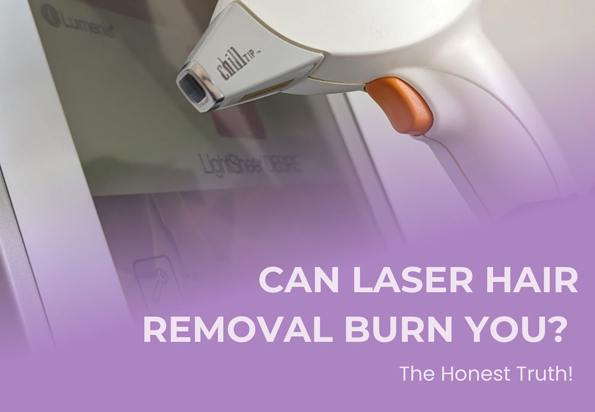 laser hair removal device